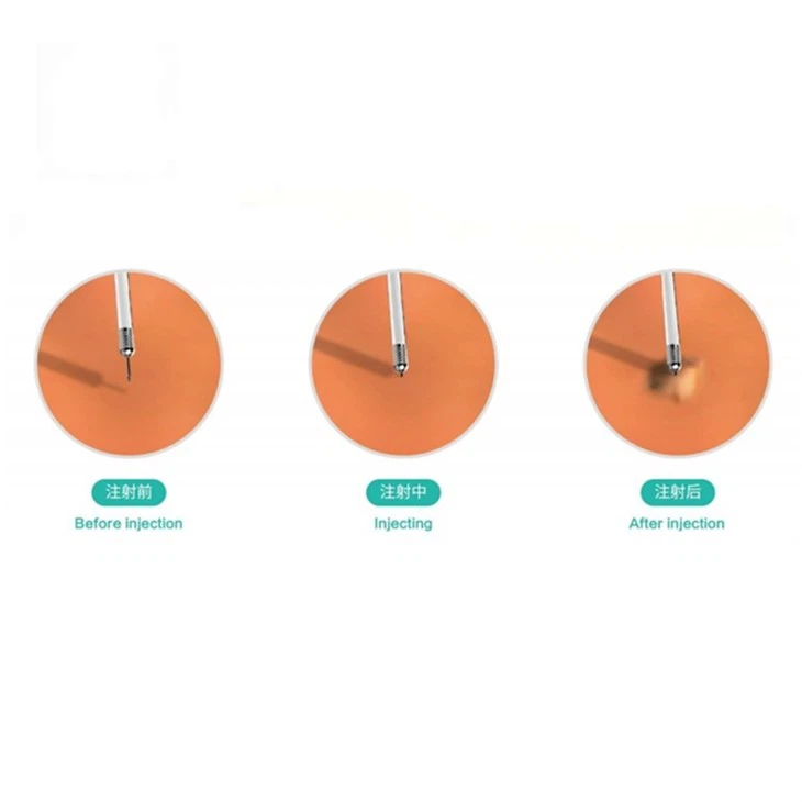 Disposable Endoscopic Injection Needle